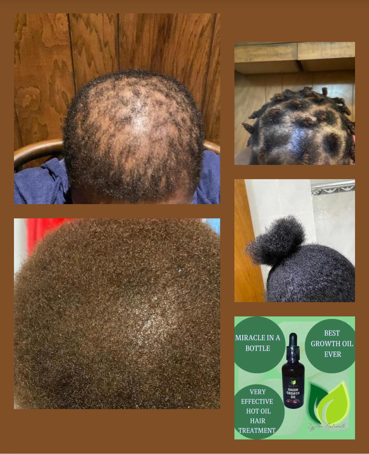 Hair Growth Oil | Organic Botanical Scalp & Hair Treatment (50ml)