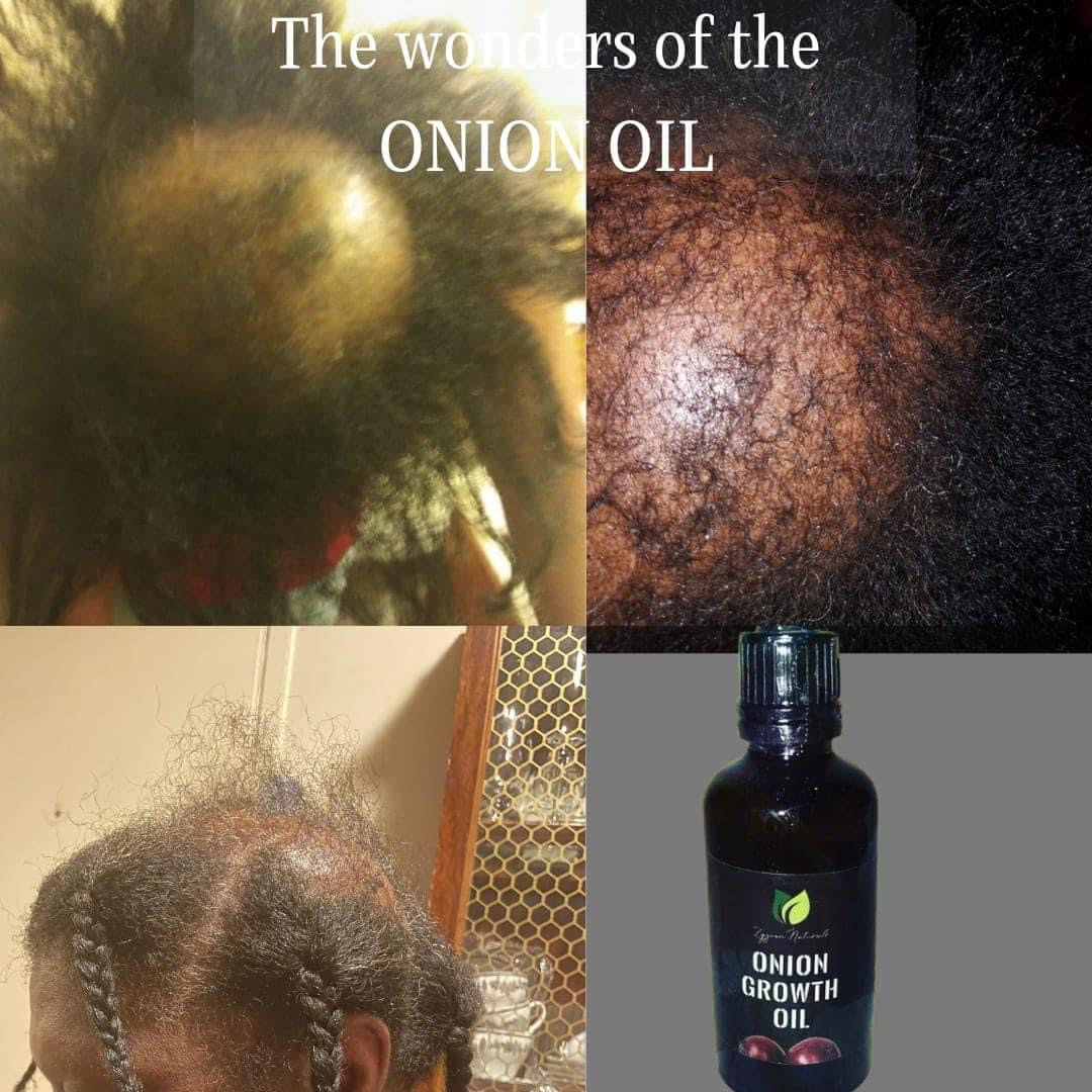 Hair Growth Oil | Organic Botanical Scalp & Hair Treatment (50ml)