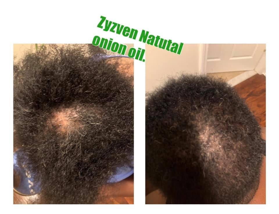 Hair Growth Oil | Organic Botanical Scalp & Hair Treatment (50ml)