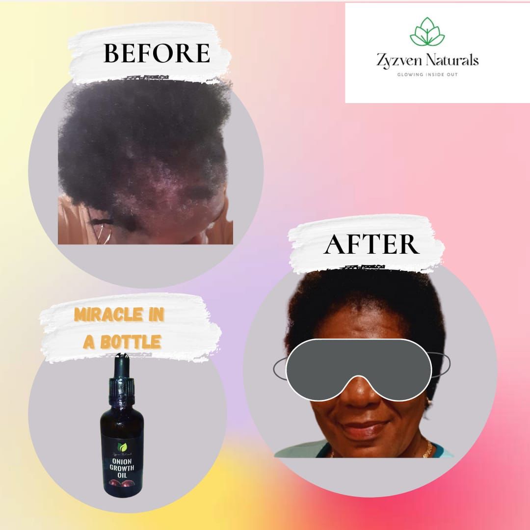 Hair Growth Oil | Organic Botanical Scalp & Hair Treatment (50ml)