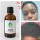 Ginger Scalp Oil (50ml) | Hair Growth & Dandruff Support with Ginger, Rosemary & Black Seed Oil