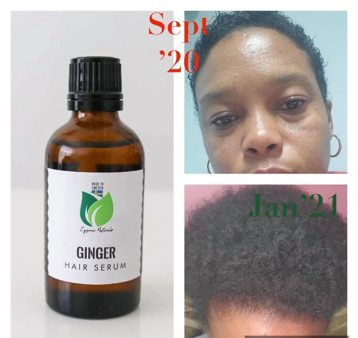 Ginger Scalp Oil (50ml) | Hair Growth & Dandruff Support with Ginger, Rosemary & Black Seed Oil