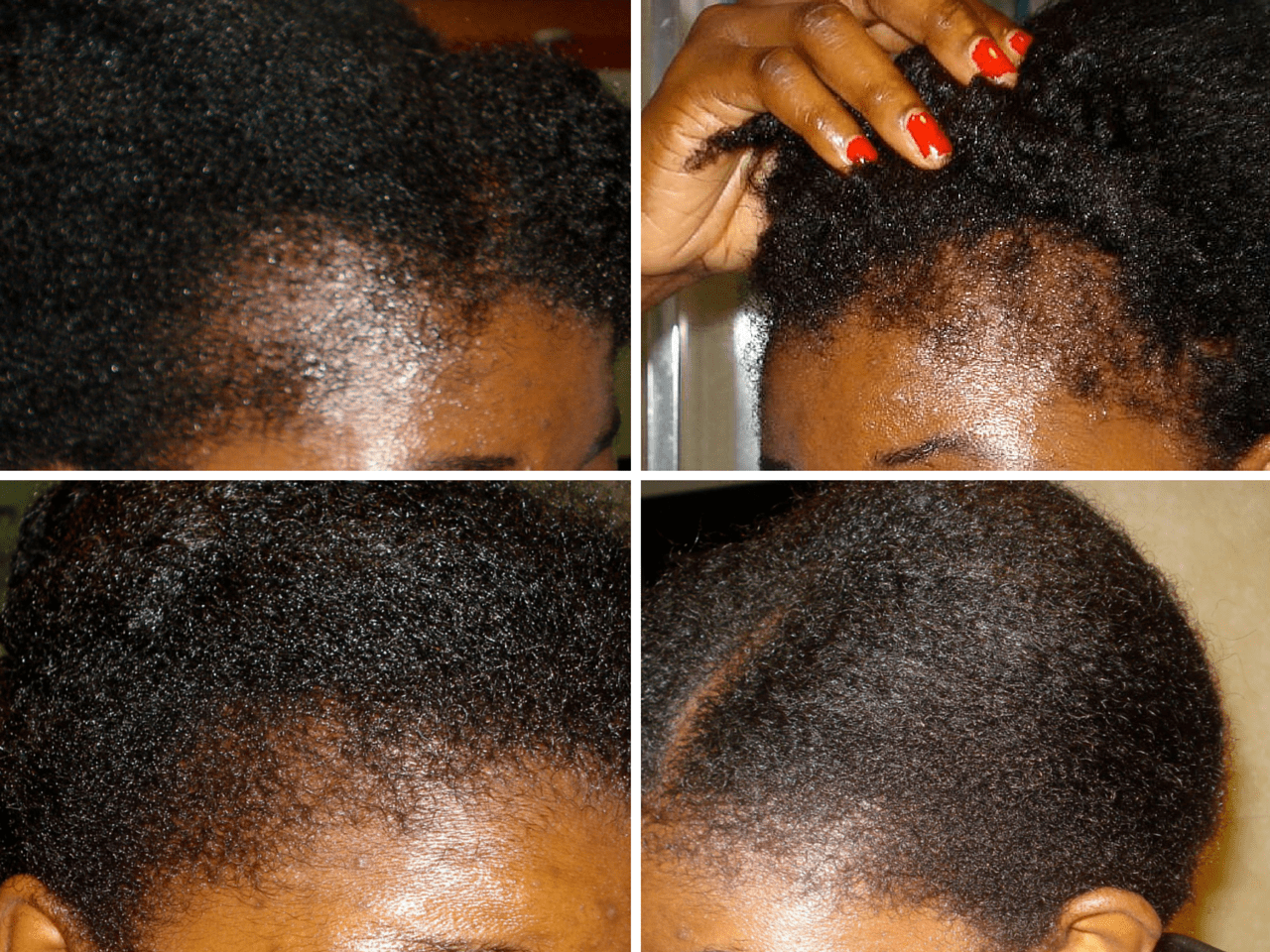 Hair Growth Oil | Organic Botanical Scalp & Hair Treatment (50ml)
