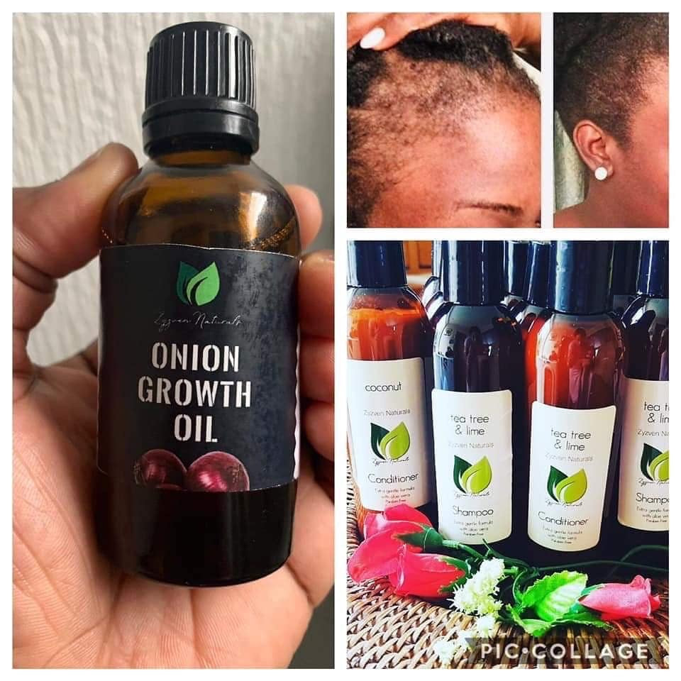 Hair Growth Oil | Organic Botanical Scalp & Hair Treatment (50ml)
