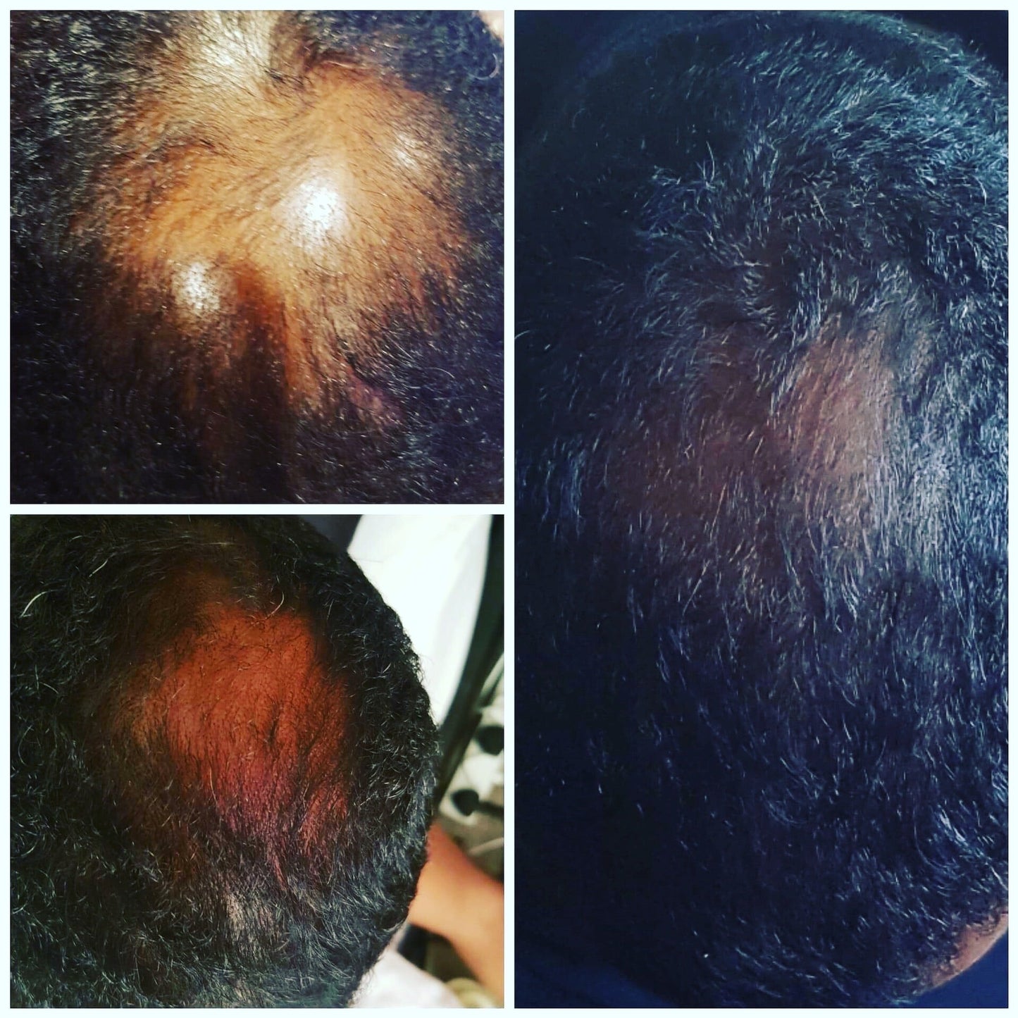 Hair Growth Oil | Organic Botanical Scalp & Hair Treatment (50ml)