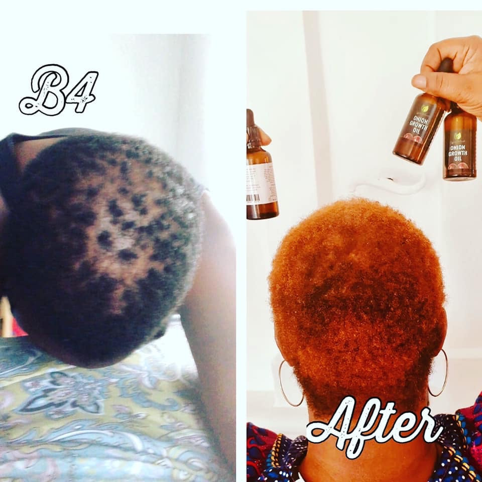 Hair Growth Oil | Organic Botanical Scalp & Hair Treatment (50ml)