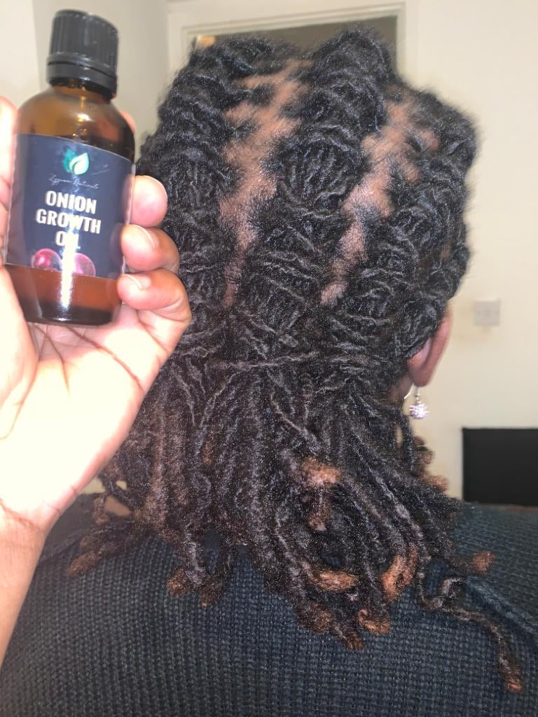 Hair Growth Oil | Organic Botanical Scalp & Hair Treatment (50ml)