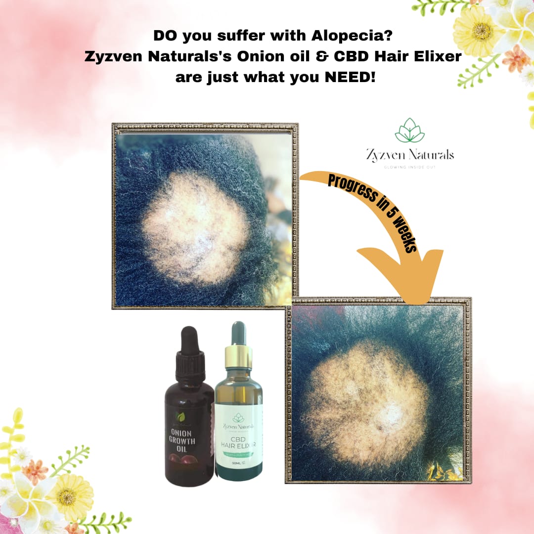 Hair Growth Oil | Organic Botanical Scalp & Hair Treatment (50ml)