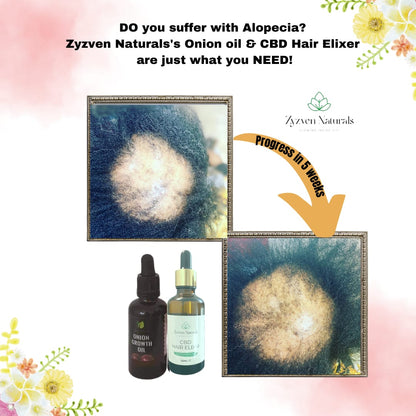 Hair Growth Oil | Organic Botanical Scalp & Hair Treatment (50ml)